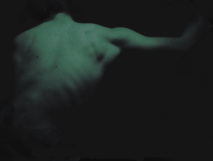 spectre deformity