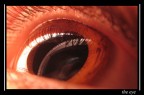 The eye The eye