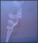 Riccioli di fumo Riccioli di fumo