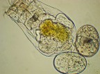 immagine al microscopio ripresa con sony DSC-W80 (compatibile con bulbo ottico microscopio)